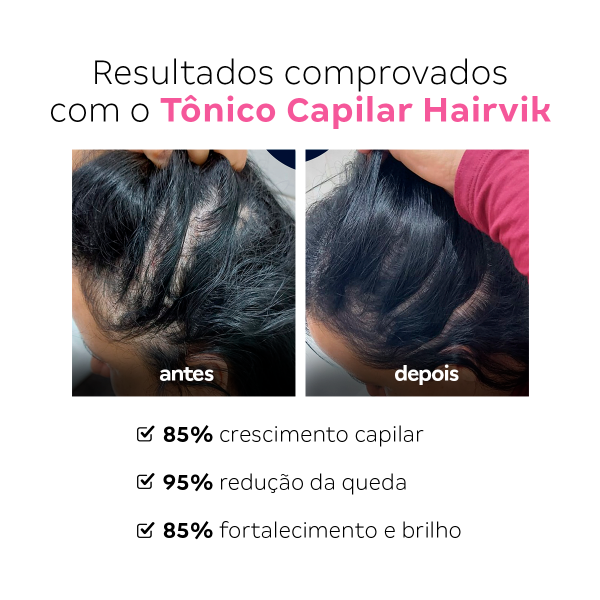 Kit Tônico Capilar Hairvik Feminino - 12 Unidades