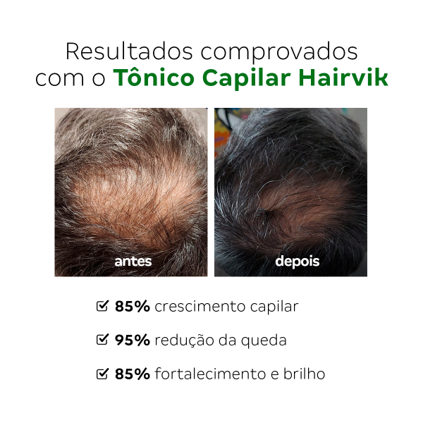 Kit Tônico Capilar Hairvik Masculino - 6 Unidades